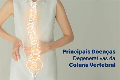 Principais Doenças Degenerativas da Coluna Vertebral Guia Saúde Cidades