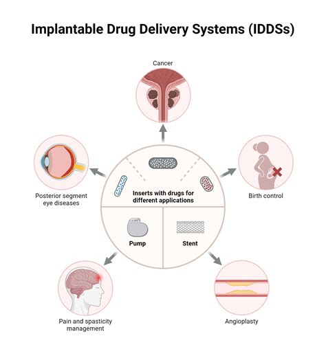 Implantable Drug Delivery Systems Iddss Biorender Science Templates