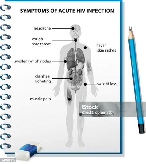 Vetores De Sintomas Do Diagrama De Infecção Aguda Pelo Hiv E Mais