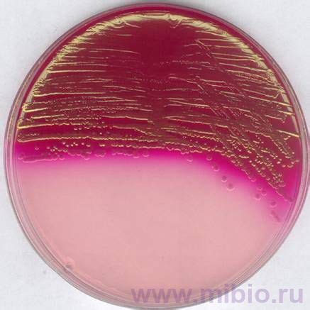 104044 Endo agar - Питательная среда - Агар Эндо - Список инструкций ...