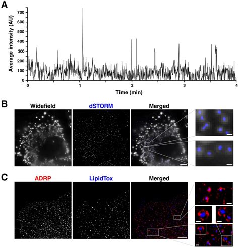 A Huh7 Lunet Cells Were Incubated With LipidTox Red Neutral Lipid