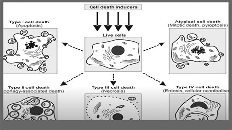 www.catchynewsworld.com — Necrosis: Types, Stages, and Treatment Options