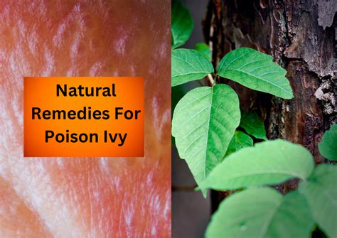 Nature's Balm: Soothing the Sting of Poison Ivy with Natural Remedies