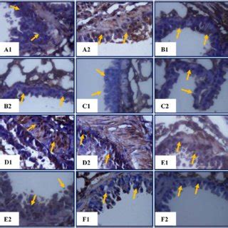 Histopathology in Balb/c Strain Mice. (A) The brown color of the cell ...