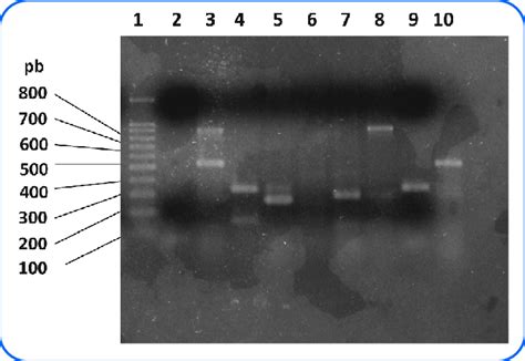 Amplificación Por Pcr Múltiple De Genes Eae Elt Est Stx Y Aggr Gel