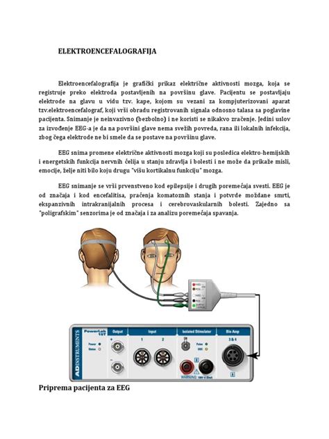 Elektroencefalografija | PDF