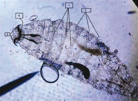 Oestrus Ovis Larvae Showing 1 Segments With Intersegmental Spine