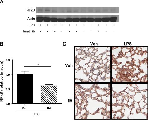 Figure From Imatinib Attenuates Inflammation And Vascular Leak In A