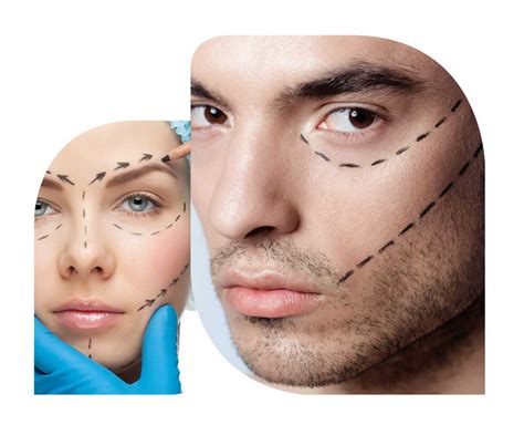 Scar Revision | Scar Correction | Cleveland Cosmetic Surgery