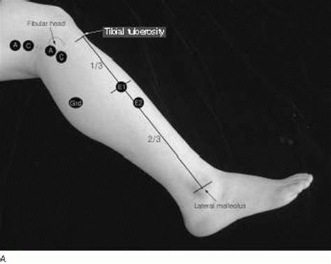 Lower Extremity Musculoskeletal Key