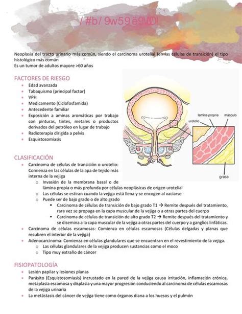 Cáncer de vejiga Raven uDocz