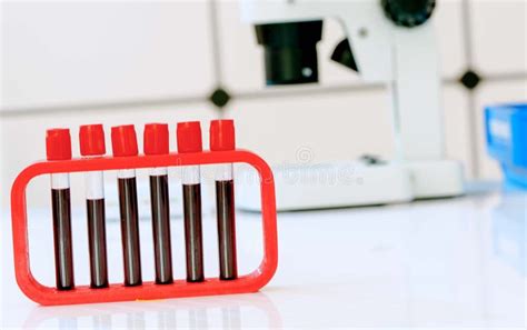 Blood Test For Hormones And Microelements In A Biochemical Laboratory