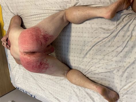 My Ass Being Whipped By My MASTER 21 Nude Pics XHamster