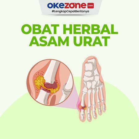 5 Obat Herbal Untuk Mengatasi Asam Urat 0 Foto Okezone Infografis