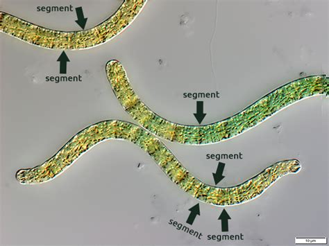 Spirulina Under The Microscope Freshly Frozen Sprulina