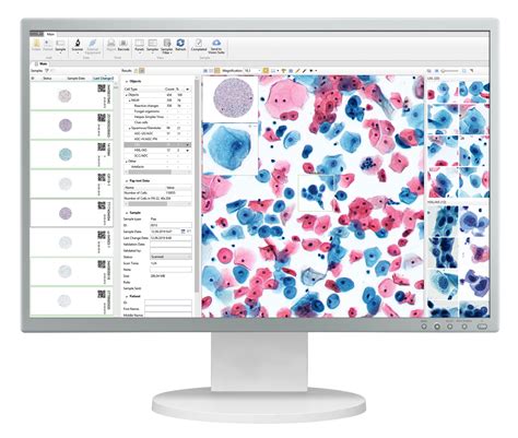 Cervical Cytology