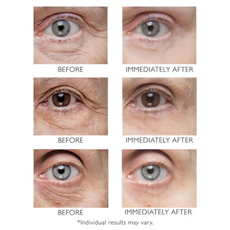 Instant FirmX: The Viral Eye Treatment With Jaw-Dropping Results