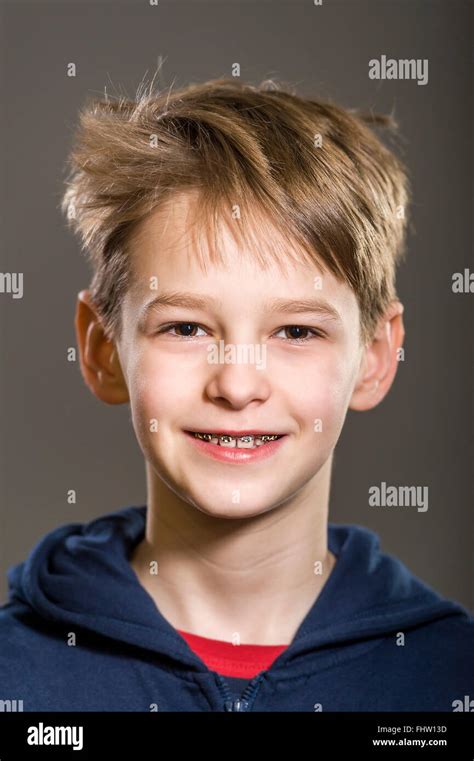 Blond Boy With Tooth Braces Hi Res Stock Photography And Images Alamy