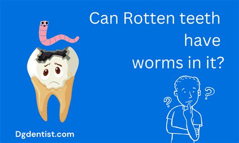 Rotten Teeth Causes Symptoms And Treatment Dg Dentist