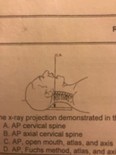Positioning Cervical And Thoracic Spine Flashcards Quizlet