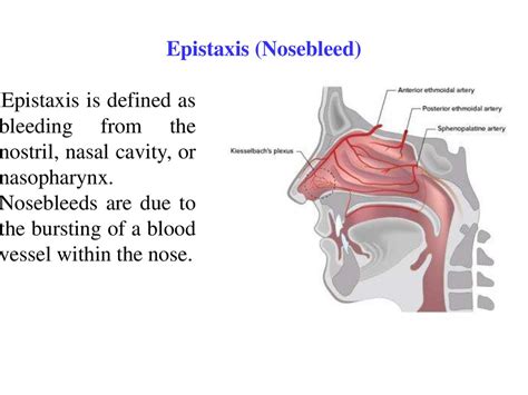 Epistaxis. Etiology, pathogenesis, clinic, diagnosis, differential ...