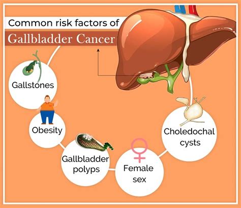 Gallbladder Cancer Treatment And Surgery Dr Nikhil Agrawal Best In Delhi India