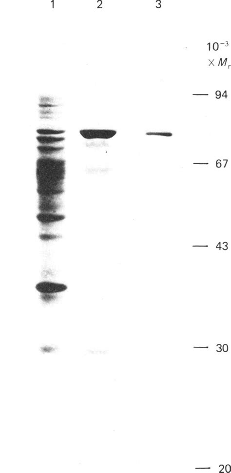 Sdspolyacrylamide Gel Electrophoresis Ofthe 75000 M Download Scientific Diagram