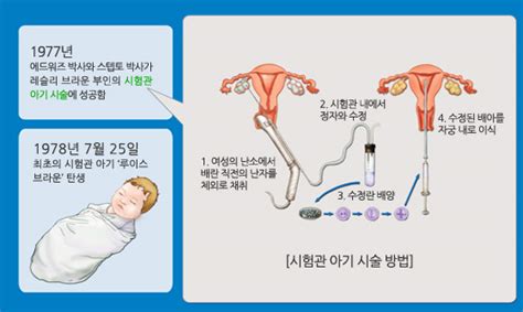 생물 산책 로버트 에드워즈 시험관 아기