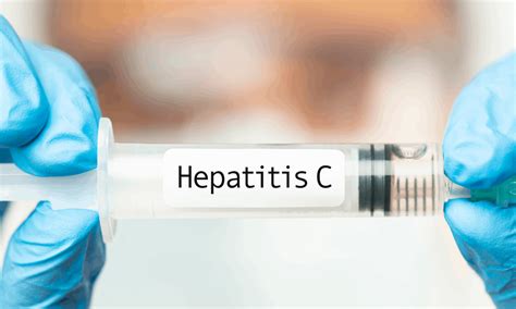 Hepatitis C Treatment Top Health Doctors