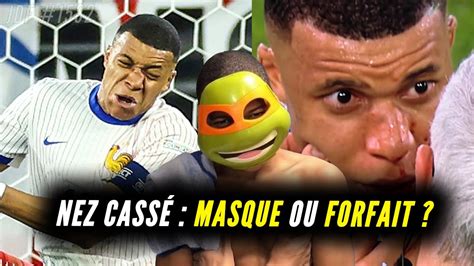 Le choc de la fracture du nez de MBAPPÉ secoue la France et enflamme