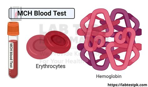 MCH blood test