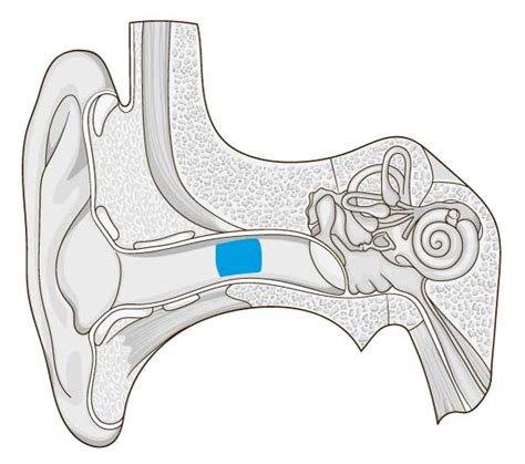 Mircrosuction Earwax Removal Clinic