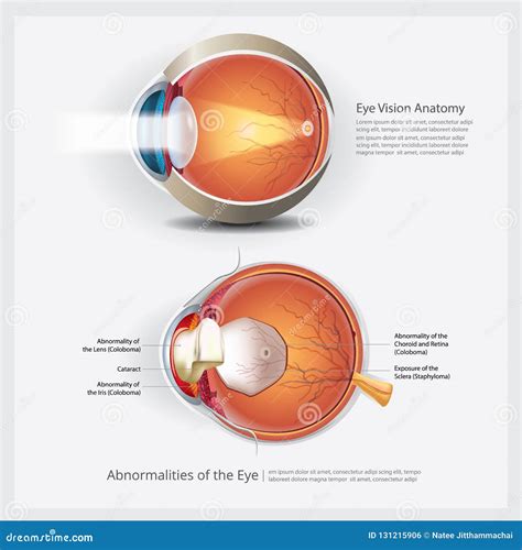 Anatomia Dell Occhio Con Le Anomalie Dell Occhio Illustrazione