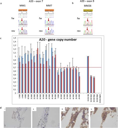 Genetic Aberrations Of A20 In Multiple Myeloma A Electropherogram Of