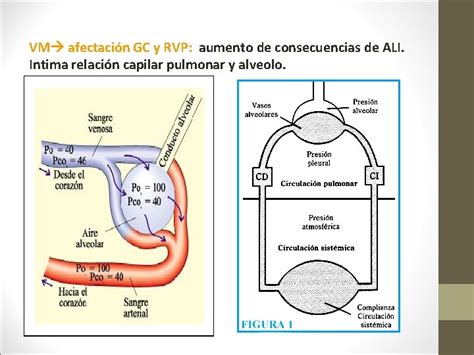 INTERACCIONES CARDIOPULMONARES EN EL DAO PULMONAR AGUDO FRANCISCO