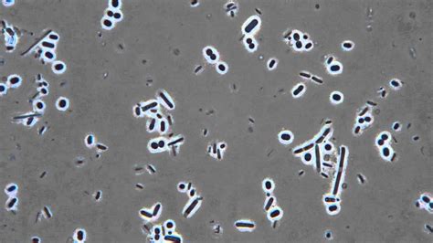 Phase Contrast Microscopy Bacteria