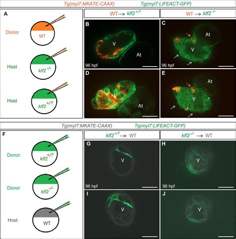 The Flow Responsive Transcription Factor Klf2 Is Required For