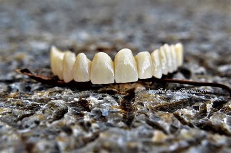 Pin By Georgina Ibanez On Mi Laboratorio Dental Art Dentistry Teeth