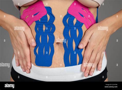 Female Belly With Physio Tape The Theme Kinesiology Taping Stretching