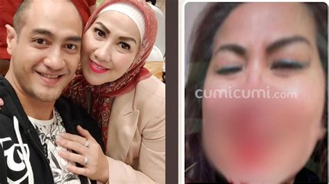 Laporkan Ferry Irawan Beredar Foto Wajah Venna Melinda Berlumuran