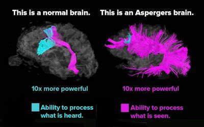 Autistic Brain Vs Normal Brain