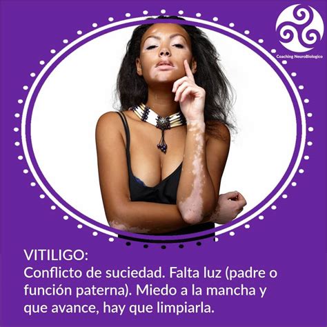 Biodescodificación del vitiligo Coaching de Salud Integral