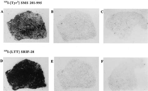 Autoradiography Of Radioactive Somatostatin Analog Binding To Ttt