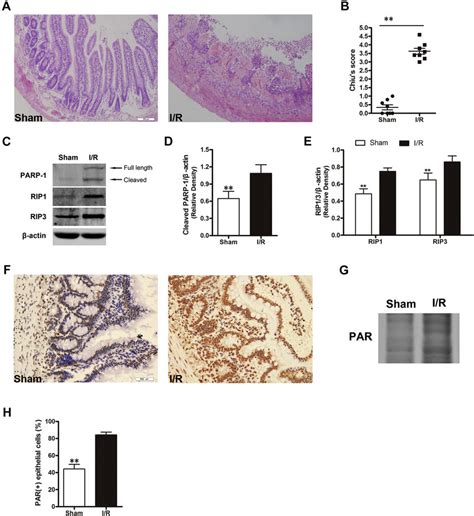 E Activation Of The PARP 1 And RIP1 3 Pathways After Intestinal I R