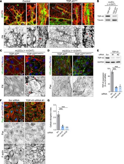 JCI Insight Endothelial TDP 43 Controls Sprouting Angiogenesis And