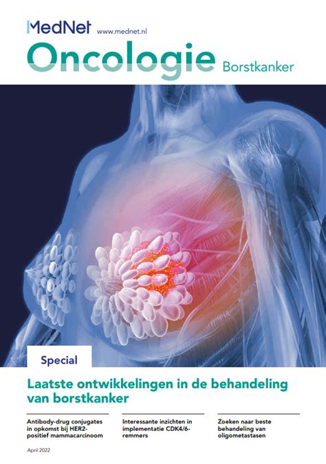 Mednet Oncologie Special Borstkanker Mednet