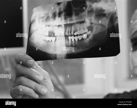 Doctor With X Ray Stock Photo Alamy