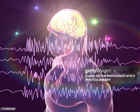 163 Epilepsy Brain Waves Stock Photos, High-Res Pictures, and Images - Getty Images