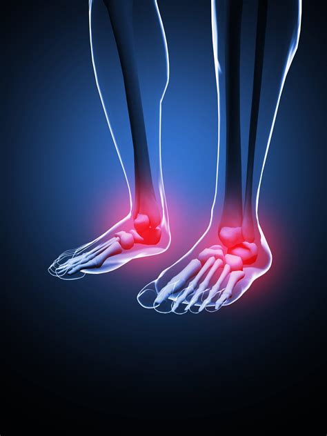 Foot Pain and Inflammation Have Many Causes That We Treat | ARAPC