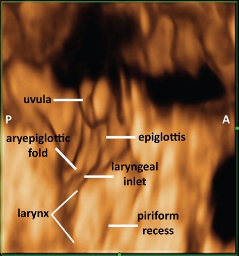 Laryngeal Inlet